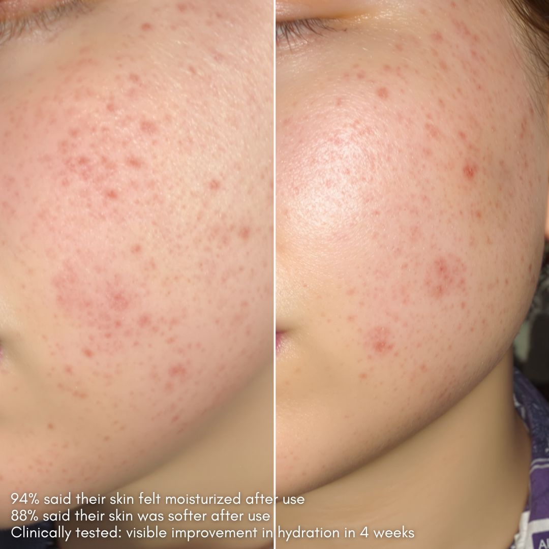 Glow 49% Jojoba Oil Serum - Delune 